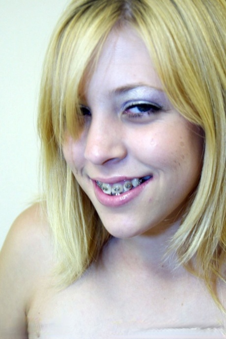 teen braces pretty photo