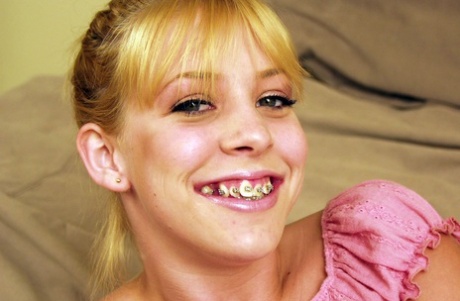 teen braces free xxx photos