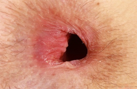 肛門 アートxxx 写真