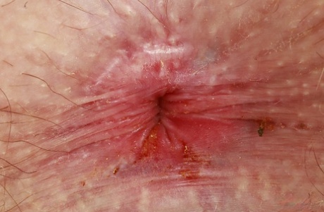 asshole close up sex pic