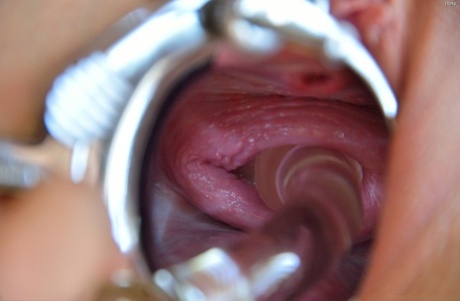 gynaecoloog volwassen xxx foto